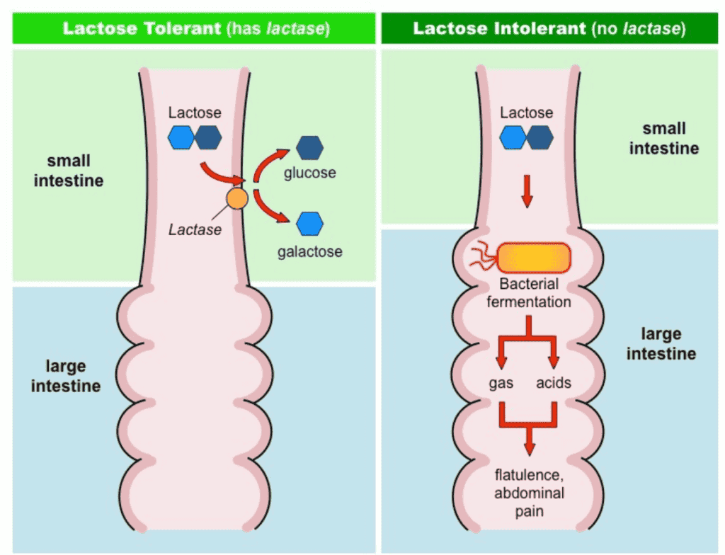 What is Lactose Intolerance? 